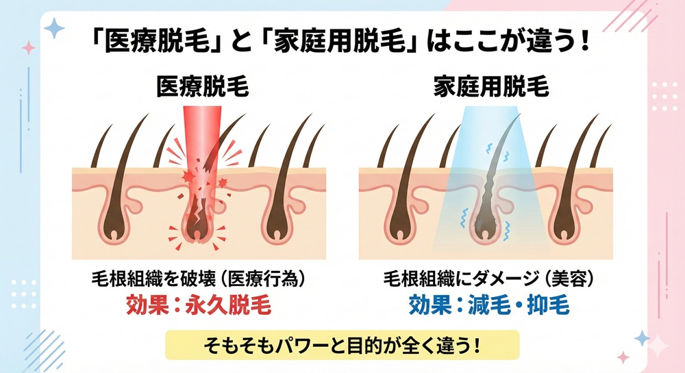 家庭用脱毛器 ぶっちゃけ