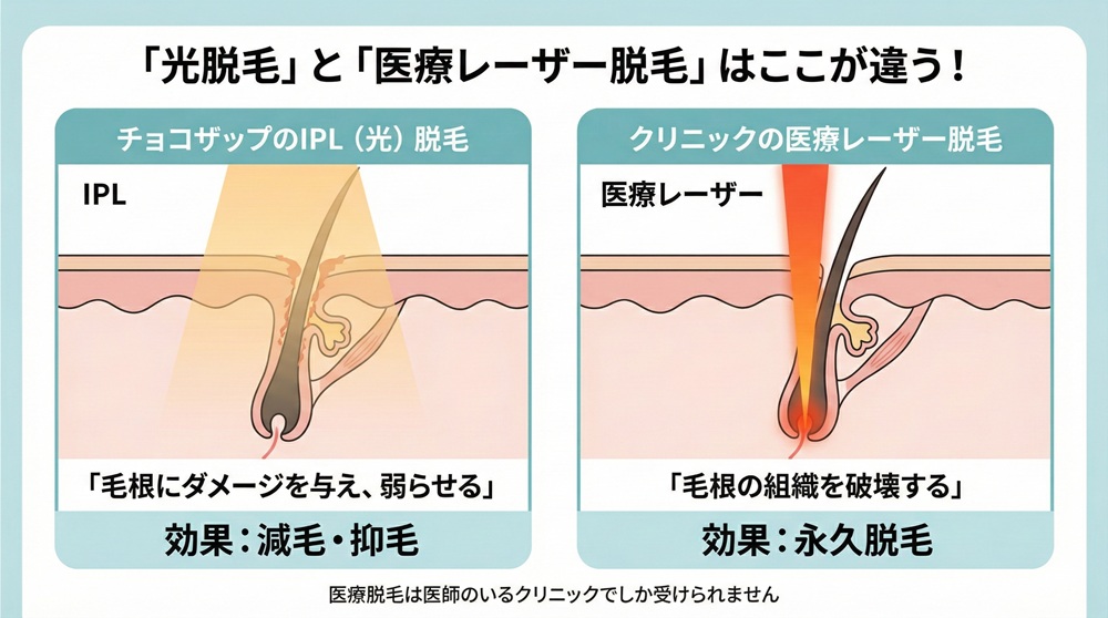 チョコザップ 脱毛